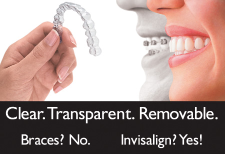 Invisalign Thousand Oaks, CA