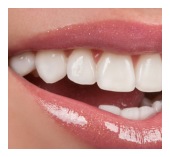 Dental Crowns