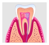 root canal